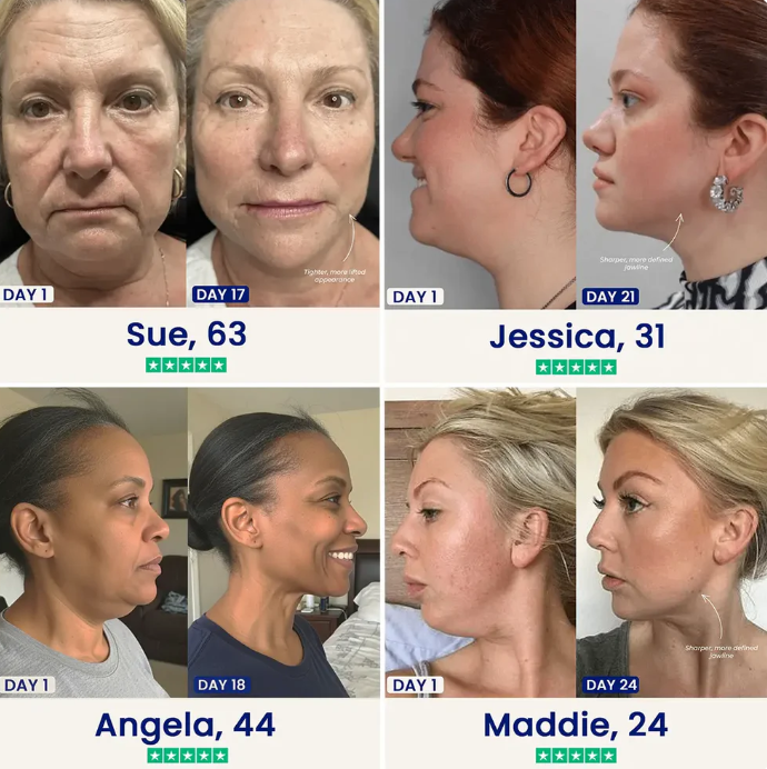 Dr.Melaxin CACTOX V-Lifting Mewing Band – Cactox