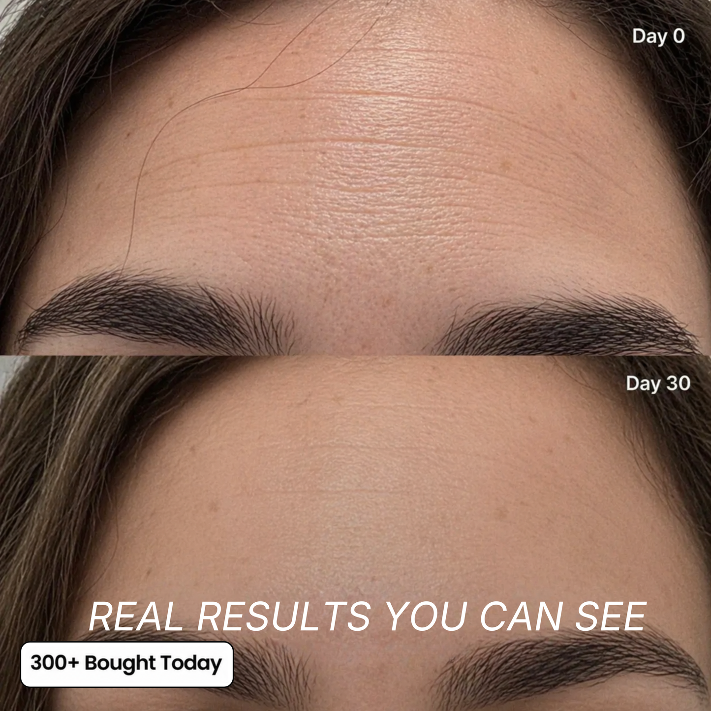 Smooth Wrinkles, Fine Lines & Tired Creases Without Needles