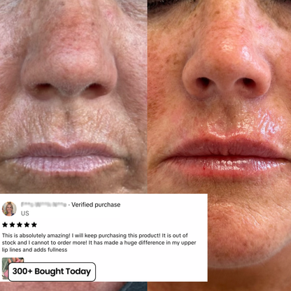 Smooth Wrinkles, Fine Lines & Tired Creases Without Needles