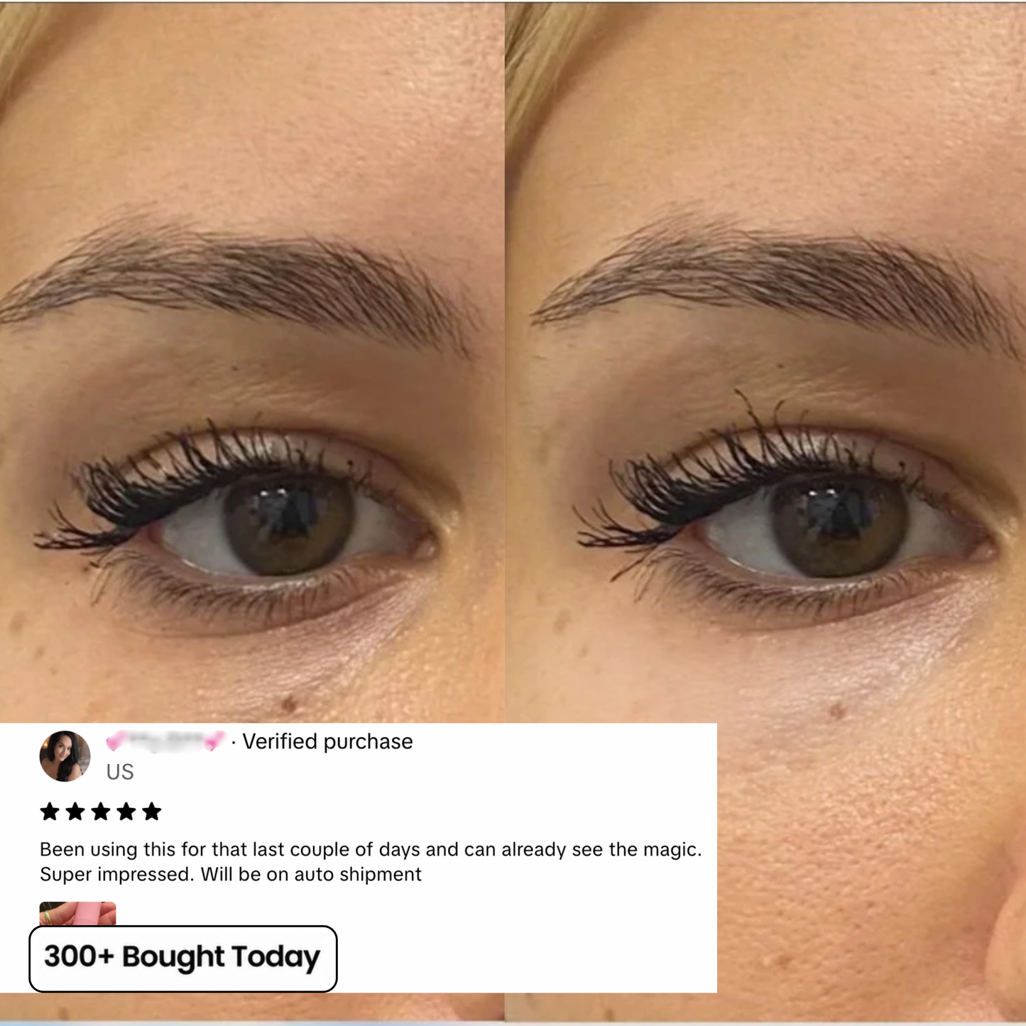 Smooth Wrinkles, Fine Lines & Tired Creases Without Needles