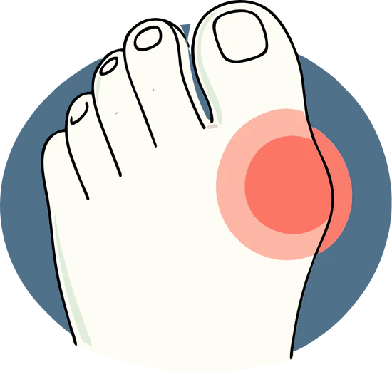 Foot pressure relief illustration